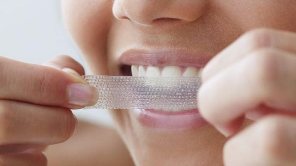 Why Should You Choose Whitening Strips Without Chlorine Dioxide in